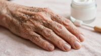 aging nail health importance